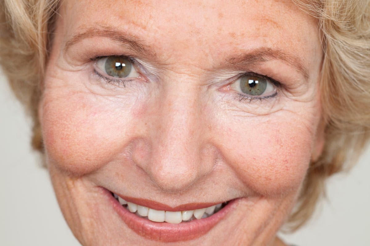 Menopausa: come alleviare i sintomi con prodotti senza ricetta